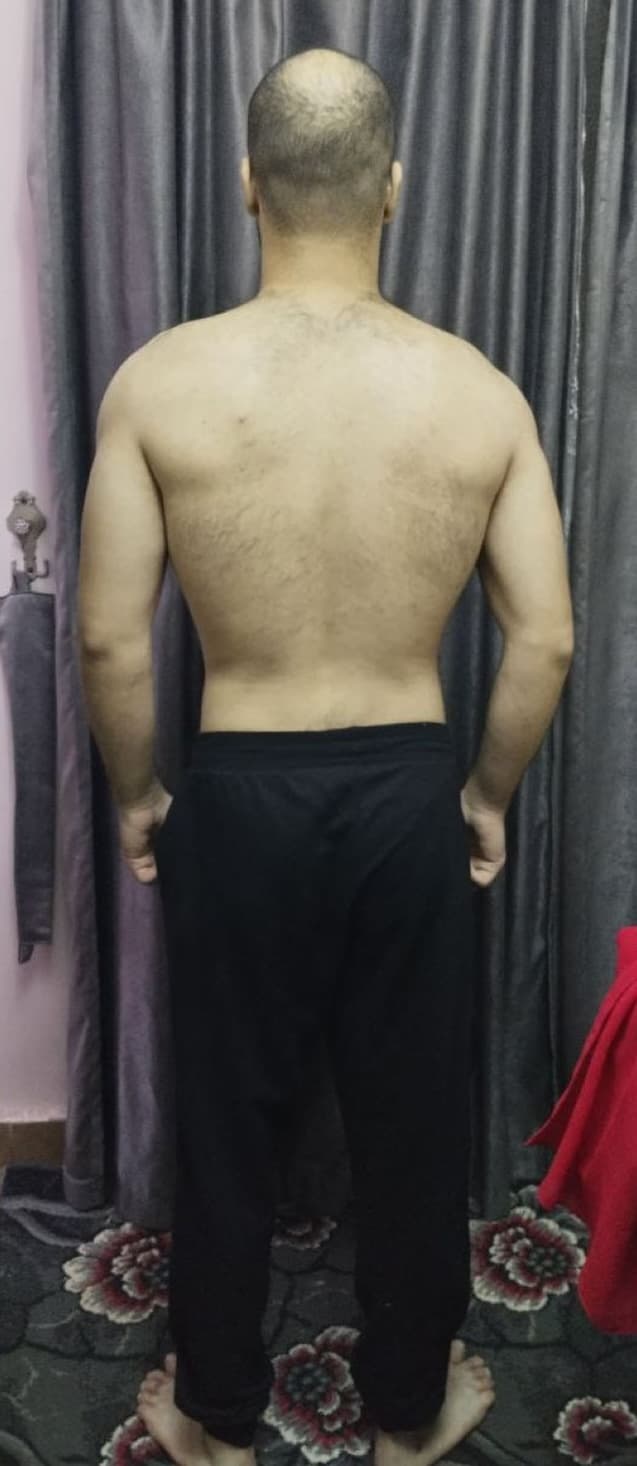 Before