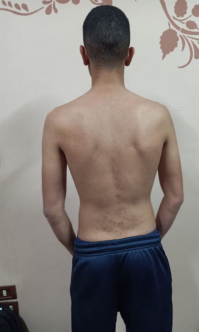 Before